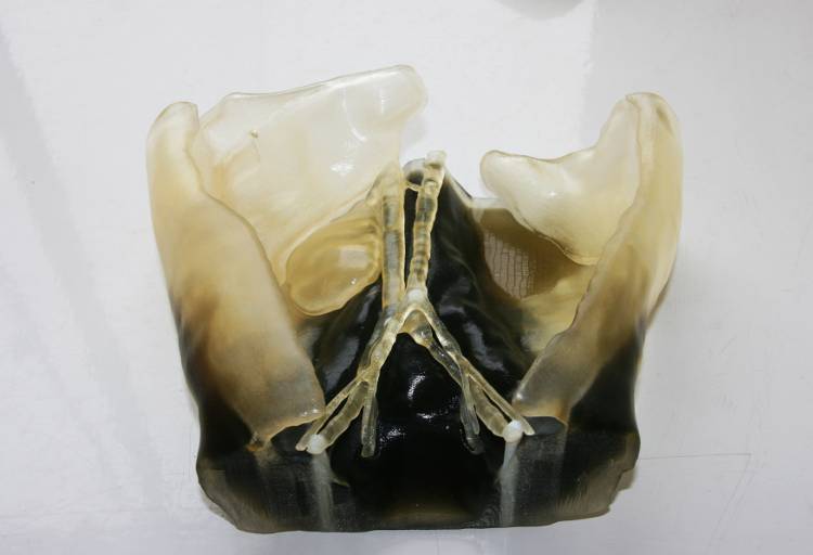 3D printed model of Dexters abdomen produced using precision multi material 3D printing technology from Stratasys